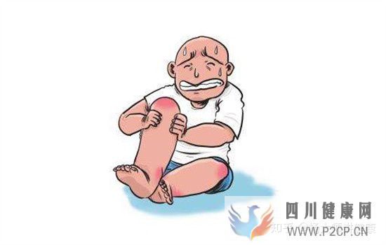風濕病的早期癥狀有哪些7大癥狀要注意(圖6)