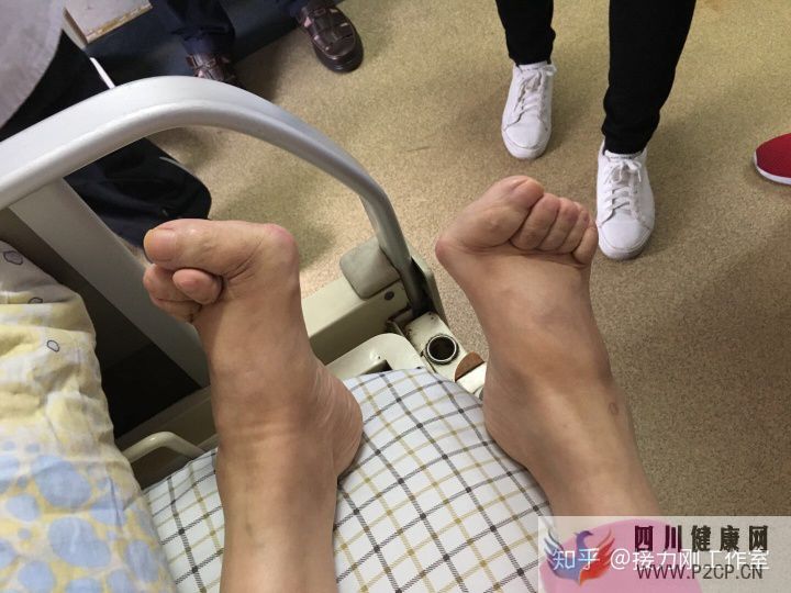風(fēng)濕病到底能不能治愈(圖1) 風(fēng)濕病到底能不能治愈(圖1)