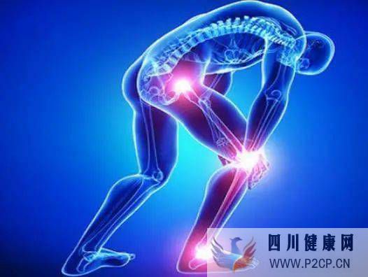 你不知道的風(fēng)濕和類風(fēng)濕的區(qū)別！(圖1)