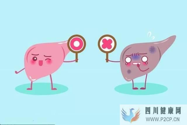 肝病多數是“拖”出來的,肝病的7個癥狀,你占了幾...(圖4)