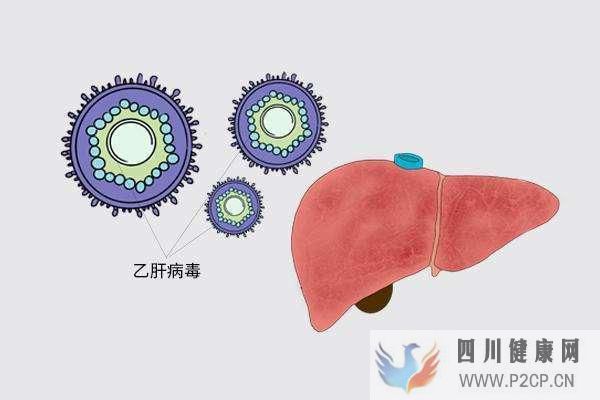 肝病多數是“拖”出來的,肝病的7個癥狀,你占了幾...(圖8)