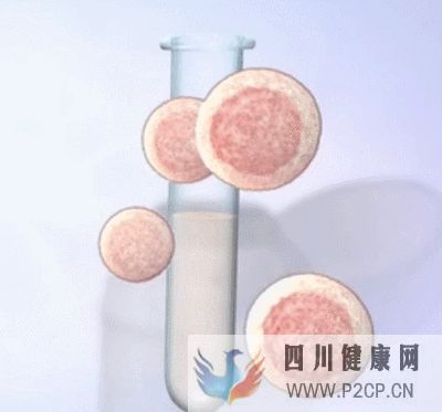 輔助生殖納入醫保啦(2022年試管嬰兒費用醫保可以報銷嗎)(圖2)