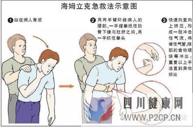 幾種常見的急救方法(圖3)