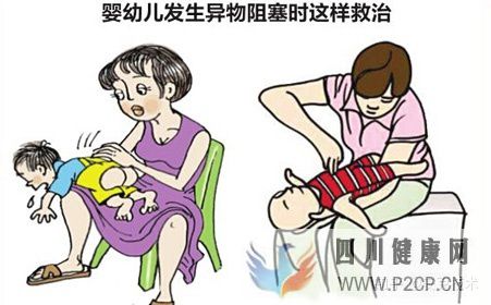 幾種常見的急救方法(圖7)