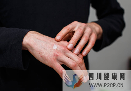酒精過敏的癥狀有哪些？如何治療酒精過敏？(圖1)