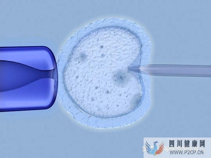 試管嬰兒1代、2代、3代、4代哪個(gè)最好真實(shí)操作過...(第二代試管嬰兒成功率有多少)(圖12)