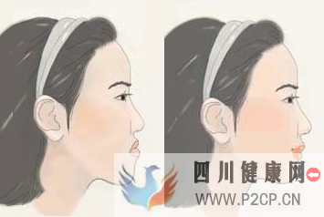 兒童地包天矯正需要多長時間(二代試管嬰兒需要多長時間)(圖2)