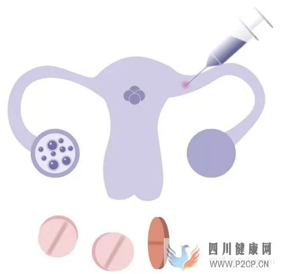 干貨女性取卵全過(guò)程(兩個(gè)女生試管嬰兒怎么做的全過(guò)程)(圖2) 干貨女性取卵全過(guò)程(兩個(gè)女生試管嬰兒怎么做的全過(guò)程)(圖2)