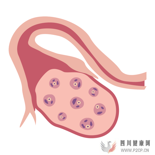 干貨女性取卵全過(guò)程(兩個(gè)女生試管嬰兒怎么做的全過(guò)程)(圖3) 干貨女性取卵全過(guò)程(兩個(gè)女生試管嬰兒怎么做的全過(guò)程)(圖3)