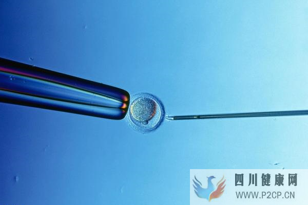 去美國做試管嬰兒生雙胞胎的概率(美國做試管嬰兒的全部費用大概是多少)(圖1)