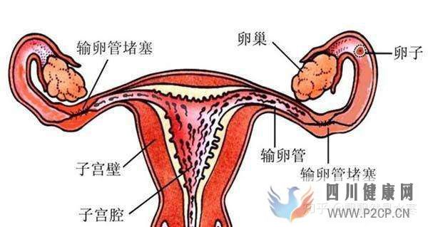 輸卵管堵塞可以做試管嬰兒嗎什么時候檢查(女方輸卵管堵塞做試管嬰兒需要多長時間)(圖1)