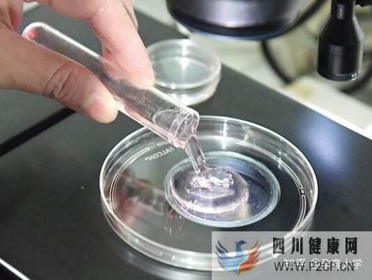 試管嬰兒是自己親生的嗎看完你就懂了!(試管嬰兒90%不是自己的)(圖4)