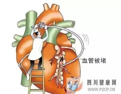 健身的十大好處,你全都知道嗎(圖12)
