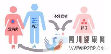 最全面詳解試管嬰兒具體流程(試管嬰兒步驟過程詳細百度)(圖2) 最全面詳解試管嬰兒具體流程(試管嬰兒步驟過程詳細百度)(圖2)