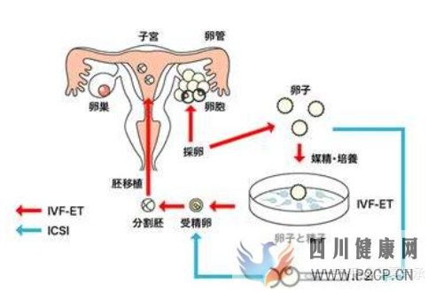 最全面詳解試管嬰兒具體流程(試管嬰兒步驟過程詳細百度)(圖6) 最全面詳解試管嬰兒具體流程(試管嬰兒步驟過程詳細百度)(圖6)