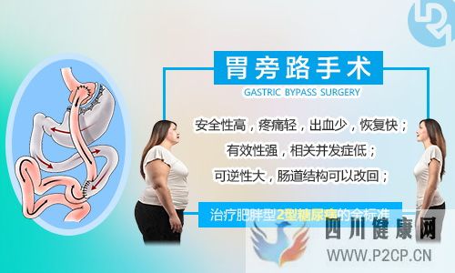 咨詢：胃旁路手術能治好糖尿病嗎？(圖2)