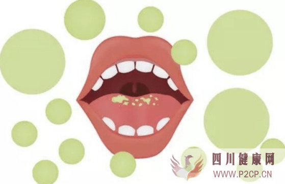 口腔健康：口腔益生菌的作用及口腔益生菌為何能有效去除口腔異味(圖1)