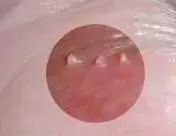 男科常見的幾種檢查項目,絕對認真!!!(圖9)