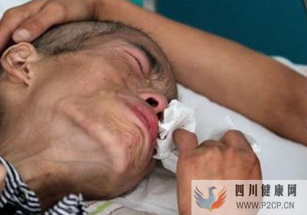 糖尿病癥狀早知道，7個征兆看出你是否有糖尿病，你都知道嗎？(圖1)