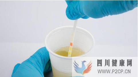 為什么到醫院住院患者一定要化驗尿液？為何尿常規屬于三大常規(圖1)