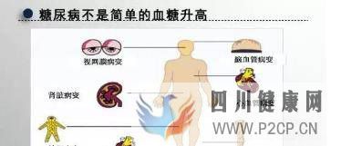多年糖尿病，如何判斷自己的糖尿病，病情輕重？(圖2)