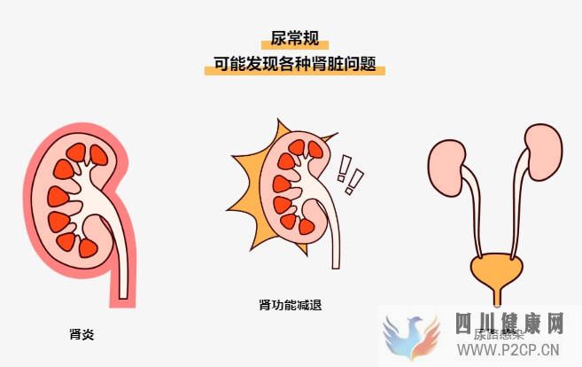 易加醫(yī)帶你漲知識(shí)：尿常規(guī)結(jié)果居然能看出這么多問題！(圖2)