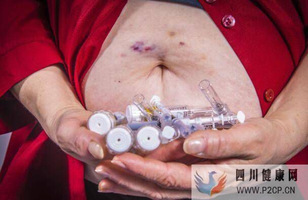 得了糖尿病，若出現這4個癥狀，你或已并發糖尿病腎病，需重視(圖1)