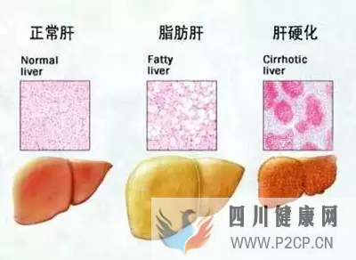 肝硬化的干細(xì)胞療法作用原理(干細(xì)胞的作用和價格表)(圖3)