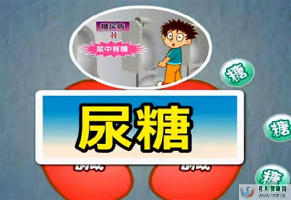尿糖陽性是糖尿病的“禍根”？醫生從多角度全面解讀，建議收藏(圖1)