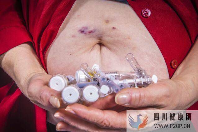 糖尿病來臨時，會有6個癥狀，若你一個不占，糖尿病離你還很遠(圖1)