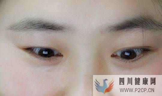 糖尿病患者，眼睛有這五個(gè)異常，可能暗示并發(fā)癥找上你，別忽視(圖1)
