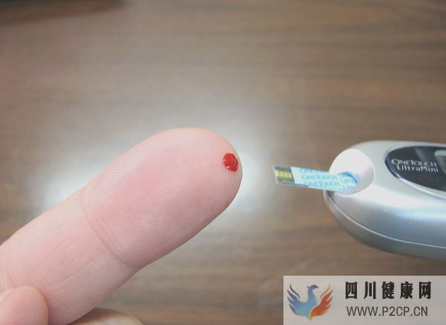 糖尿病酮癥酸中毒有哪些癥狀?糖尿病酮癥酸中毒如何處理?(圖1) 糖尿病酮癥酸中毒有哪些癥狀?糖尿病酮癥酸中毒如何處理?(圖1)