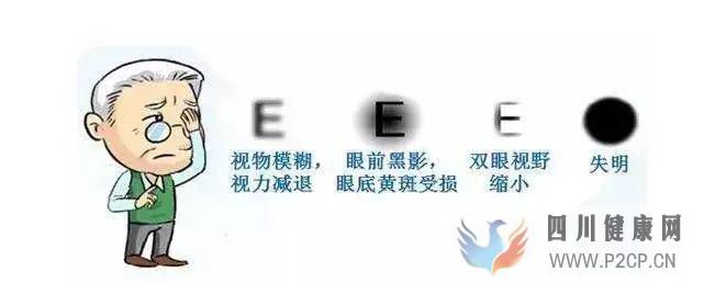 白內障有哪些癥狀？貴陽白內障手術醫院(圖1)