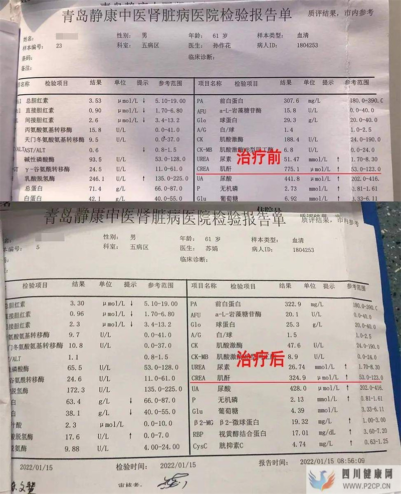 青島靜康中醫(yī)糖尿病腎病患者為什么要比其它腎病透析早？(圖1)
