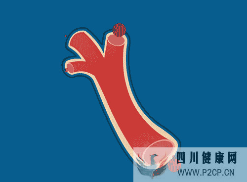 冬季做好這些事，不給心血管“添堵”，專家解讀心血管的早期預防(圖1)