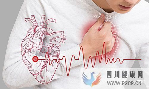 心血管疾病的4個癥狀常被忽視(圖1)
