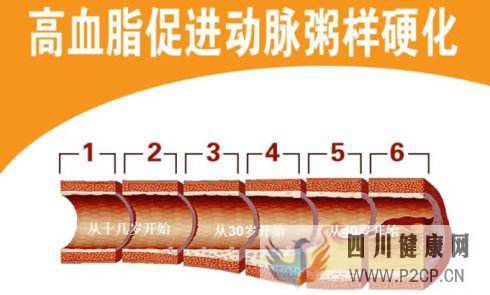 糖尿病血脂異常的5大癥狀表現！(圖1)