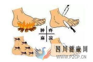 糖尿病下肢血管病變以后會出現什么癥狀？(圖1)