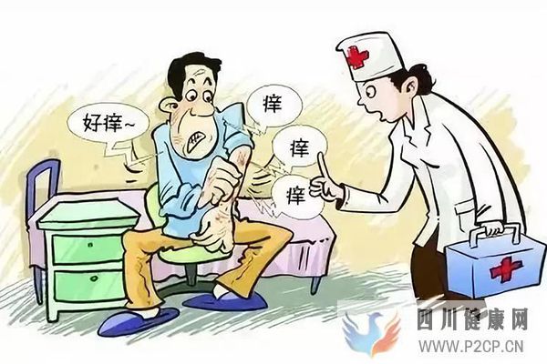 銀屑病是怎么引起的？(圖2)
