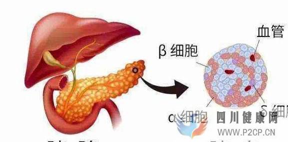 糖尿病是吃糖吃出來的？得了糖尿病還能吃糖嗎？很多朋友沒搞清楚(圖1)