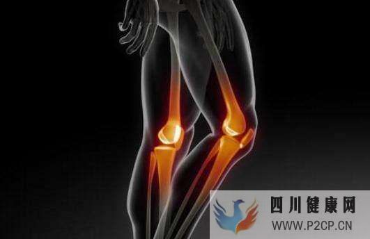 膝關節骨性關節炎的癥狀有哪些怎么治療比較好健康百科(圖1)