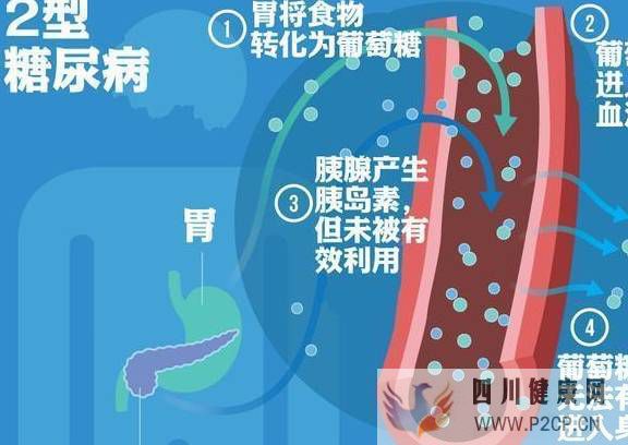2型糖尿病要怎么治(圖1)
