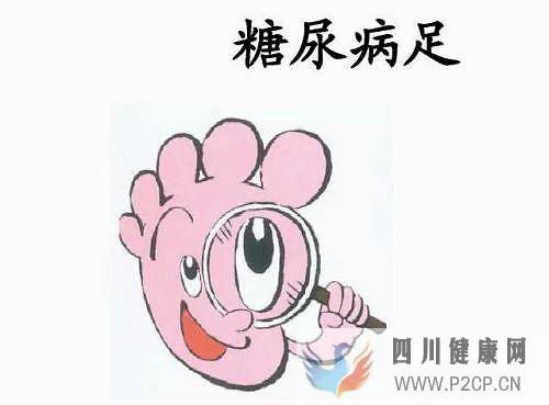 如何自查是否患上糖尿病足？(圖1)