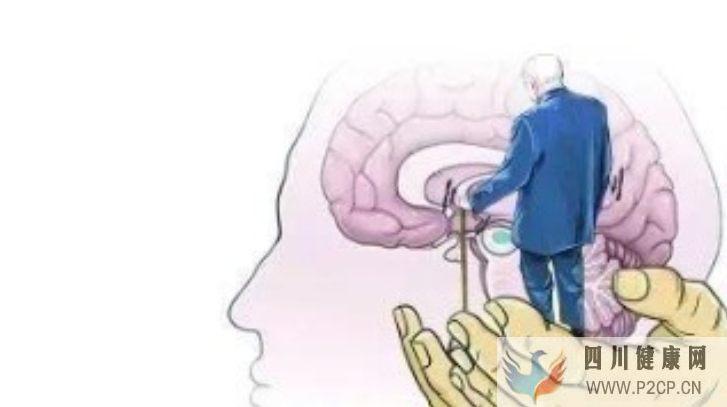 小腦萎縮都有哪些癥狀?要怎么治療?(圖1) 小腦萎縮都有哪些癥狀?要怎么治療?(圖1)