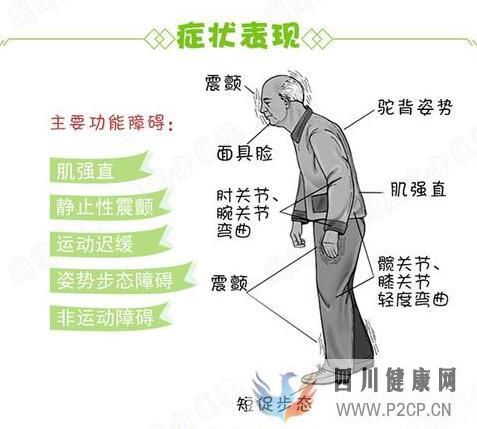 什么是震顫麻痹，震顫麻痹都有哪些癥狀，怎么樣治療？(圖1)