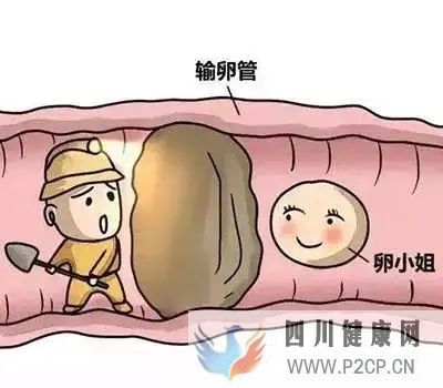 輸卵管堵塞自己會(huì)有感覺(jué)嗎(圖1)