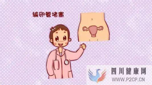 輸卵管堵塞也是分類型的(圖1)