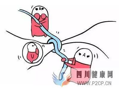 輸卵管堵塞患者的注意事項(圖1)