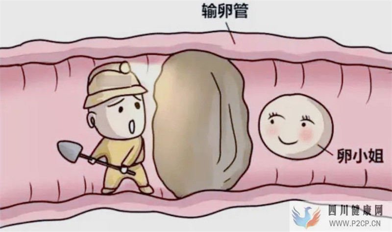 輸卵管堵塞跟男人也有關系?(圖1) 輸卵管堵塞跟男人也有關系?(圖1)