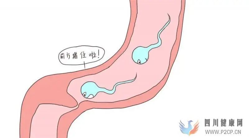 輸卵管堵塞會有哪些癥狀(圖1)